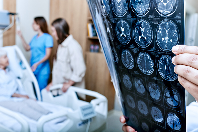 Common Symptoms of a TBI